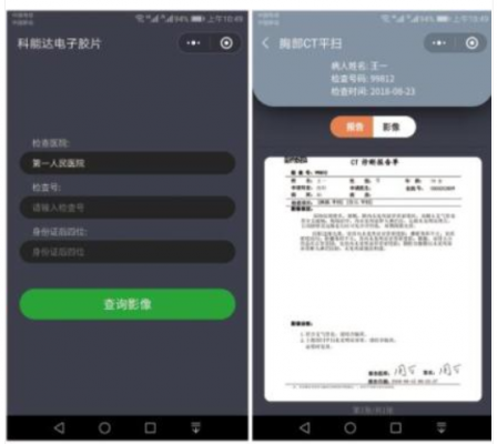 醫(yī)用電子膠片軟件med electronic film廠(chǎng)家